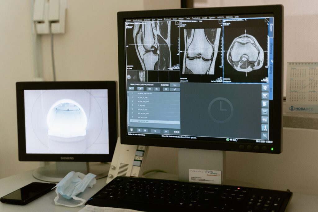 https://ecopearth.com/a-comprehensive-overview-of-cbct-scanning-in-2023/