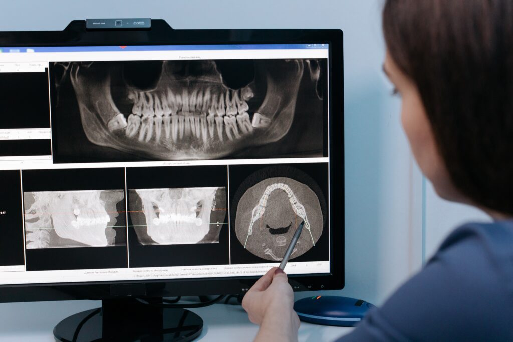 https://ecopearth.com/what-are-the-benefits-of-cbct-scanner-dental-in-2023/