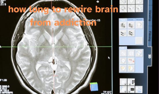 how long to rewire brain from addiction