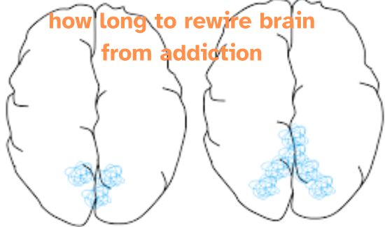 how long to rewire brain from addiction