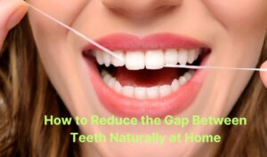 How to Reduce the Gap Between Teeth Naturally at Home